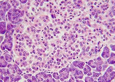 Nueva patente de Univalle representaría un gran avance para la cura de la diabetes